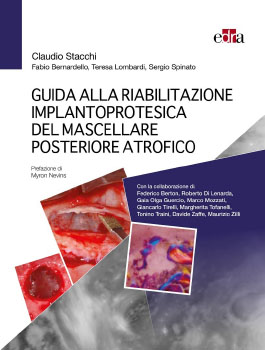 Guida alla riabilitazione implantoprotesica del mascellare posteriore atrofico